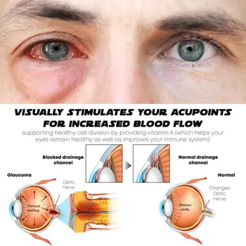 Göz Yıkama Artefakt Atomize Yüz Göz Yıkama Temizleme Vapur Yıkama Kabartma Yorgunluk Anti-inflamatuar Antibakteriyel Kuru Semptom E U5C3
